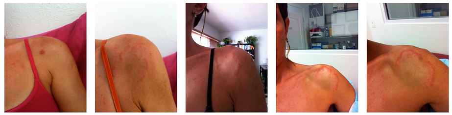 ana-healing-journey.3